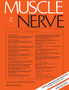 Rare combination of myasthenia and motor neuronopathy, responsive to Msc-Ntf stem cell therapy
