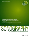 Sonography
